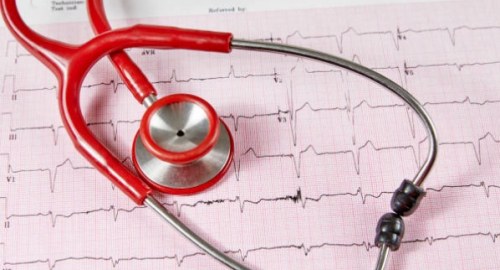 Le sfide delle decisioni di anticoagulazione nella fibrillazione atriale